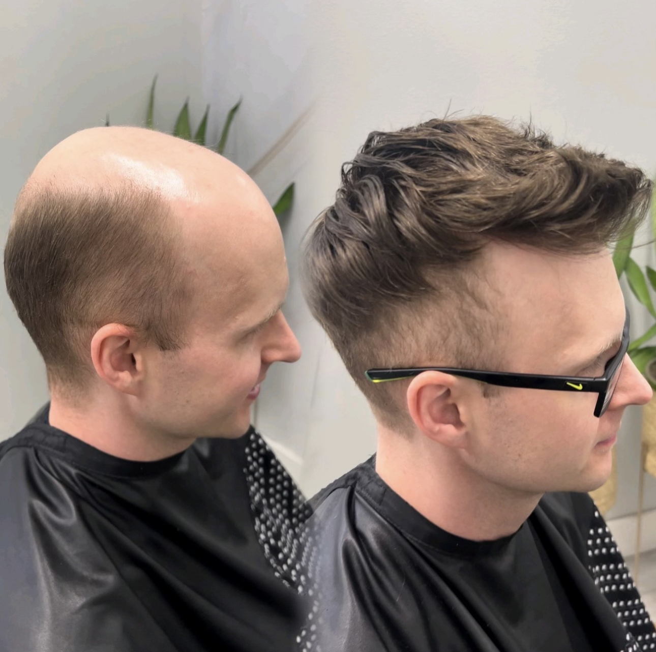 Hair system consultation style example in Alpharetta, Georgia