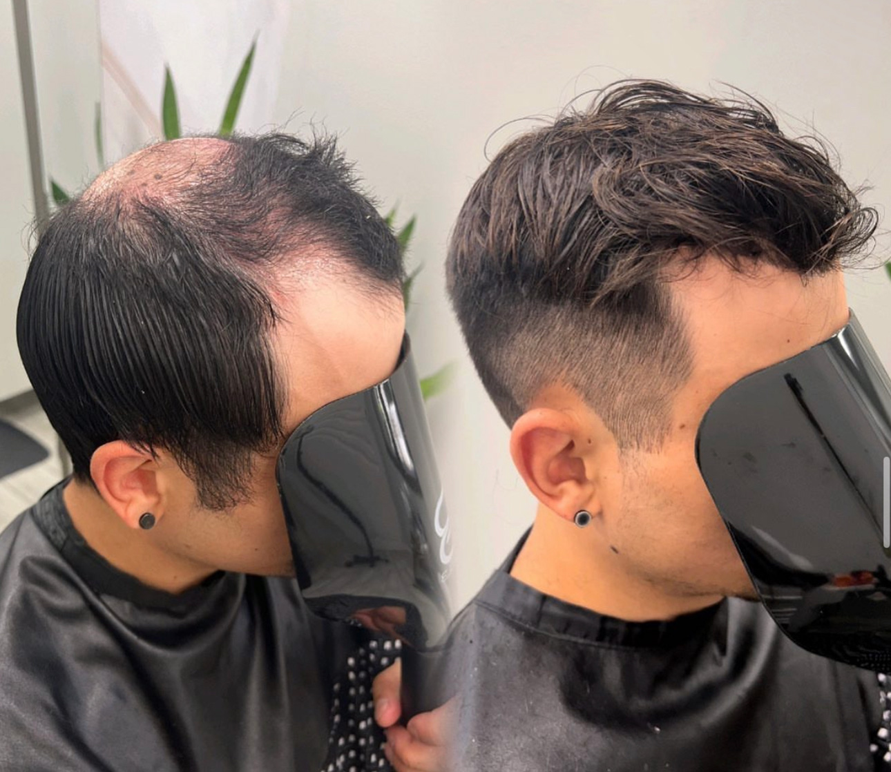 Hair system style example for Alpharetta, Georgia consultation