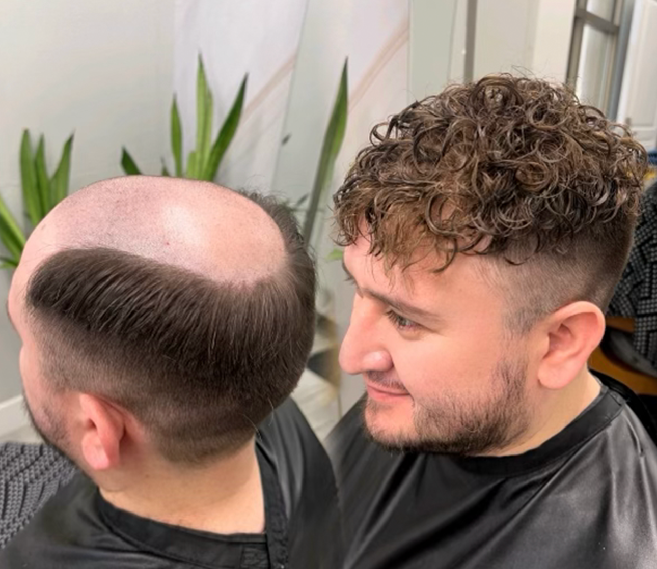 Non-surgical hair system style example in Alpharetta, Georgia