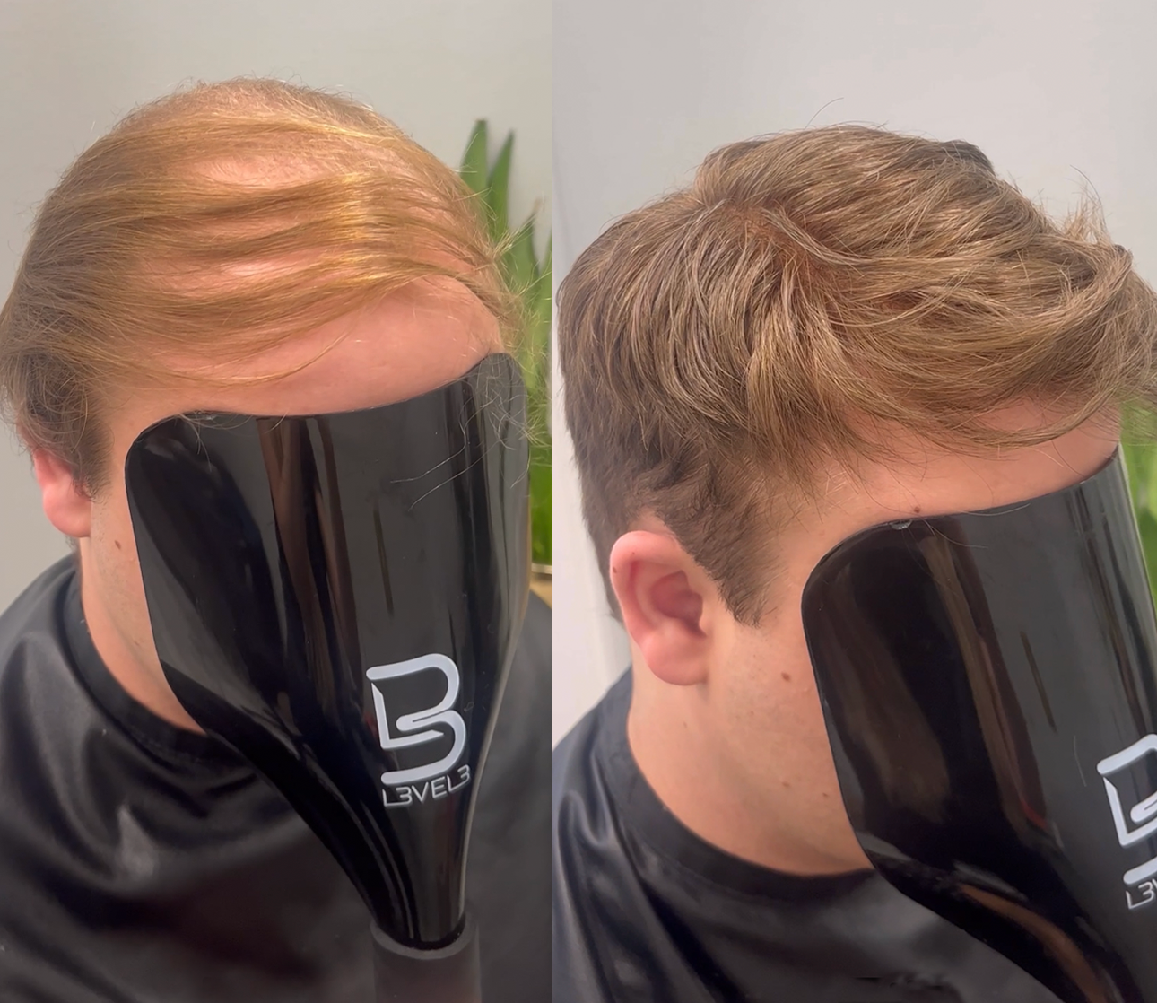 Fuller-looking hair system style example in Alpharetta, Georgia