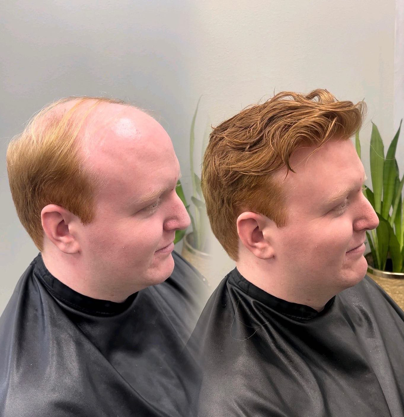 Second hair system before-and-after style example in Alpharetta, Georgia