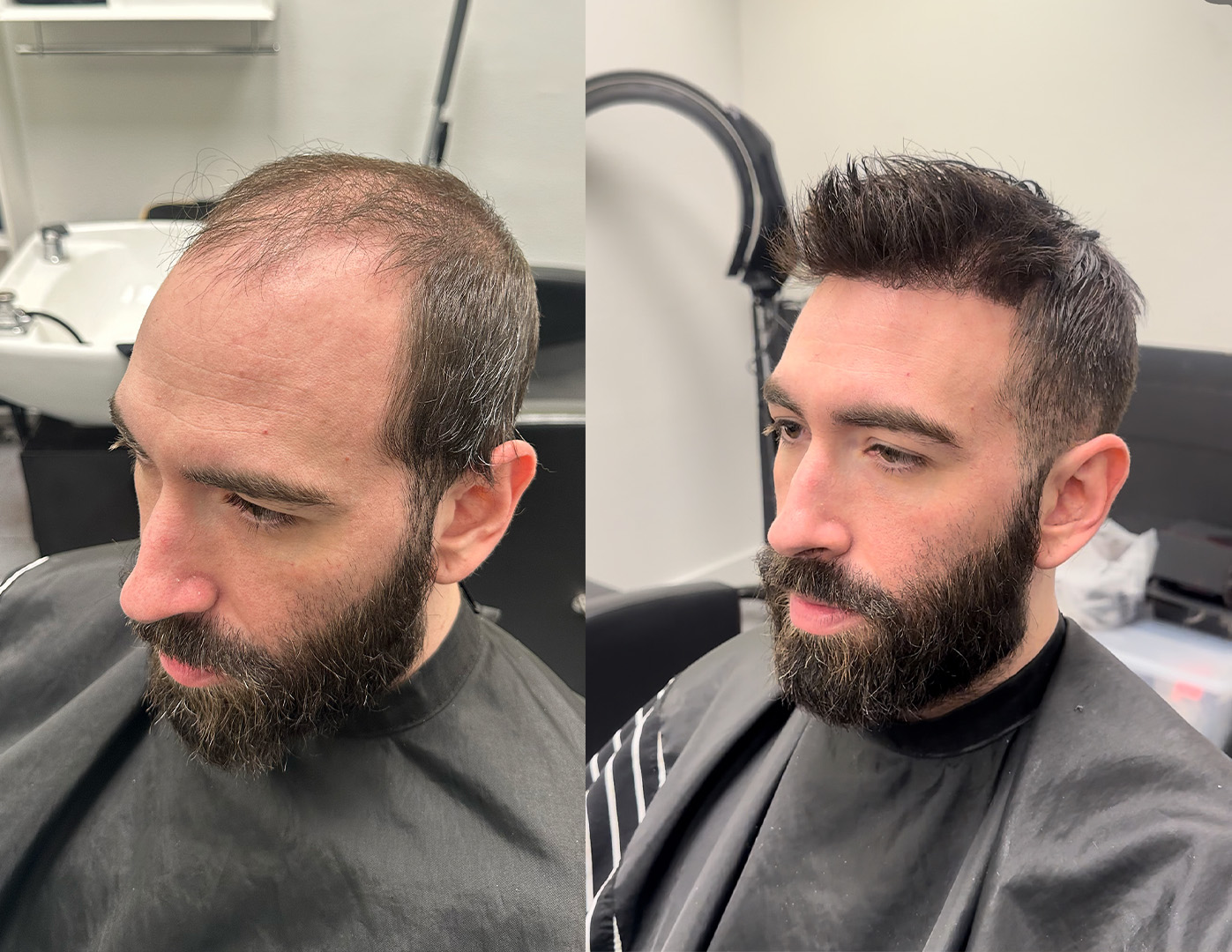 Hair system before-and-after style example in Alpharetta, Georgia